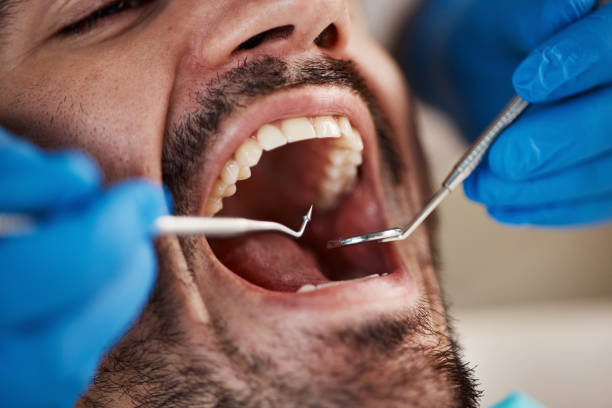 Best Pediatric Emergency Dentist in Rohnert Park, CA